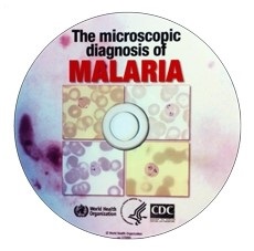 Malaria_report_CD