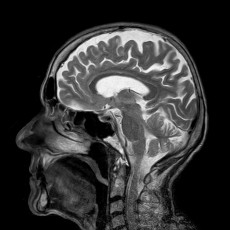 Logo Oberarzt für Radiologie (m/w/d) Schweiz