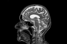 Logo Chefarzt für Radiologie / Neuroradiologie (m/w/d)