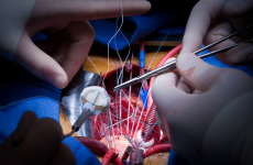 Chefarzt für Innere Medizin und Kardiologie (m/w/d)