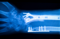 Orthop&auml;die