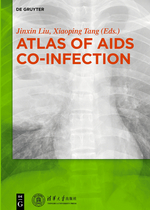Atlas of Aids Co-Infection
