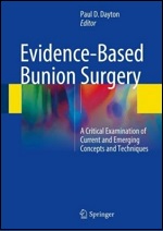 Bunion Surgery