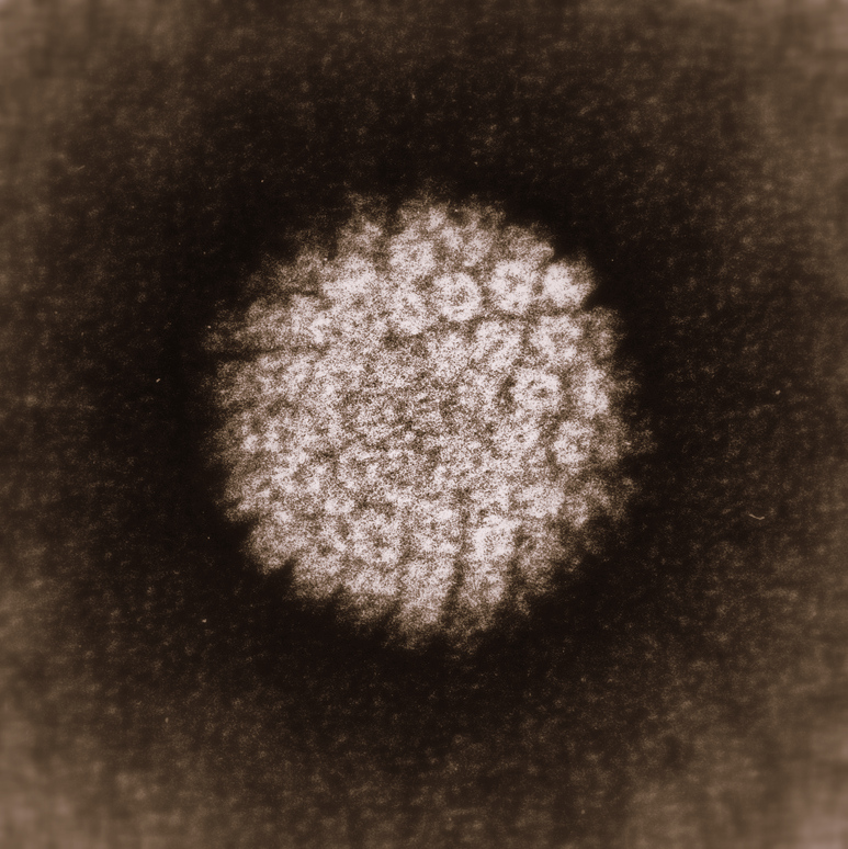 Human papillomavirus (HPV)